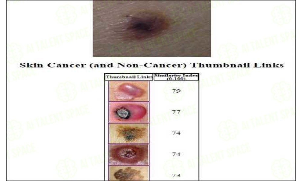 Skin Lesion Image Comparison - Image 1