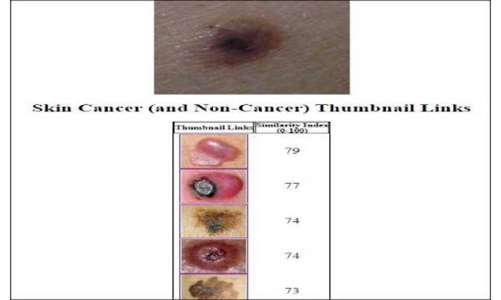 Skin Lesion Image Comparison