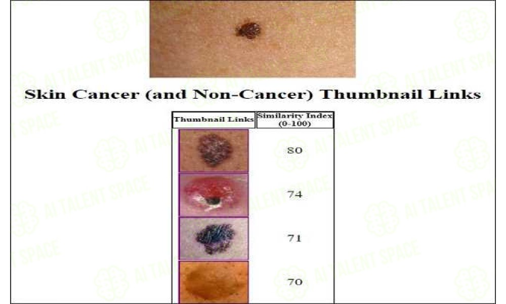 Skin Lesion Image Comparison - Image 2