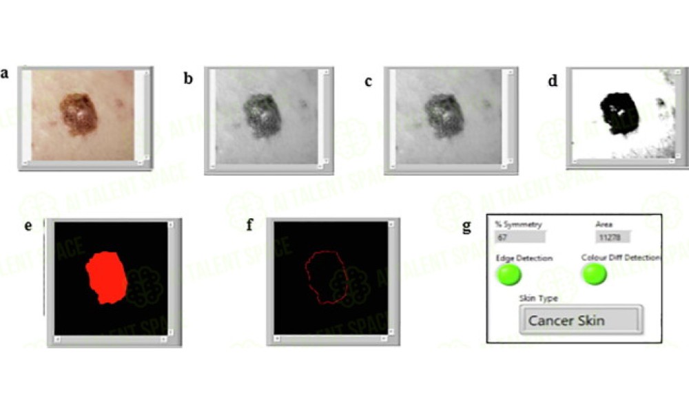 Skin Lesion Image Comparison - Image 5