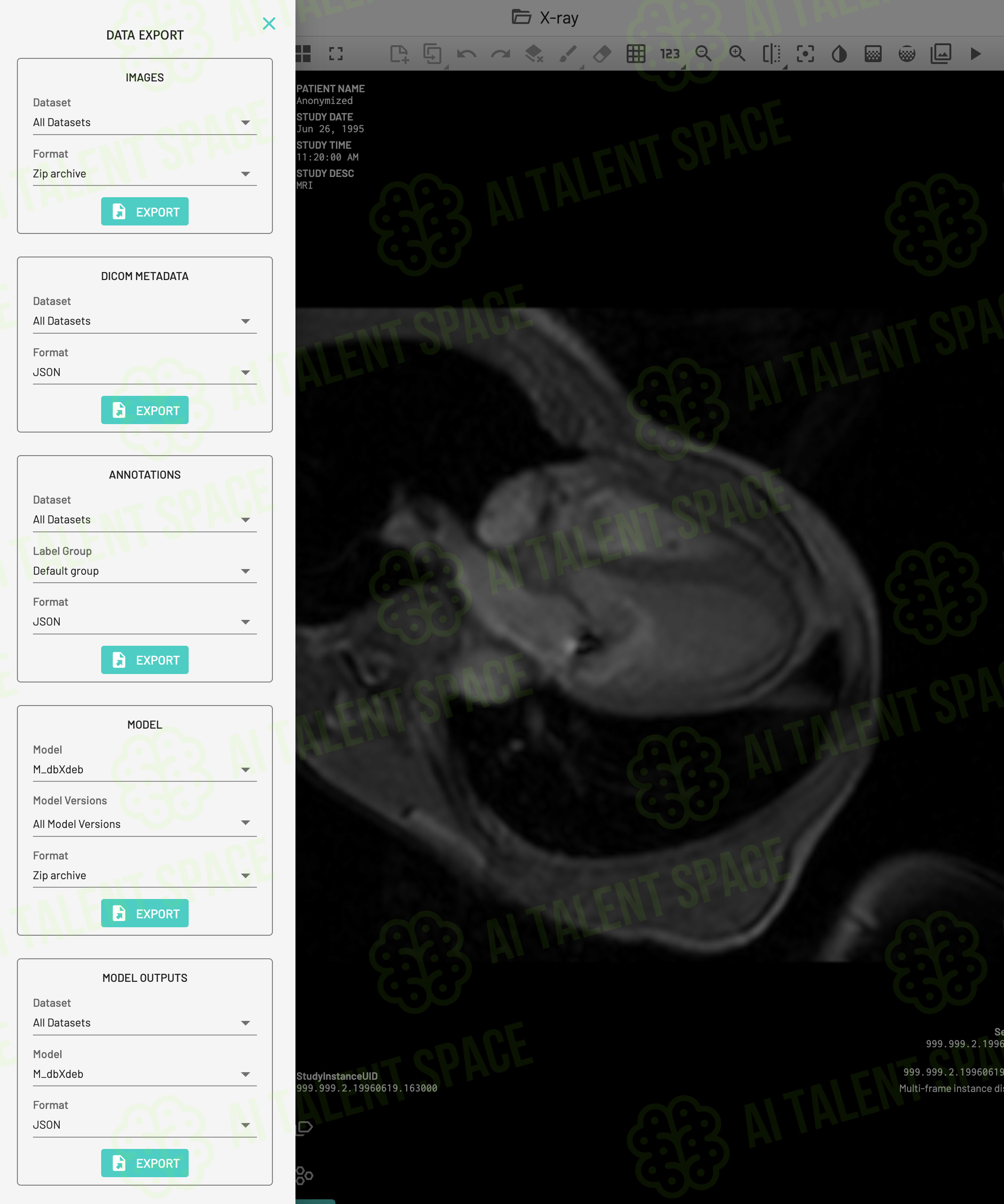 MD.ai - Image 2